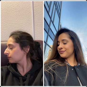 Slider image (8) Dr. Kemal Uslu Clinic